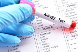 ALLERGY TEST DRUG